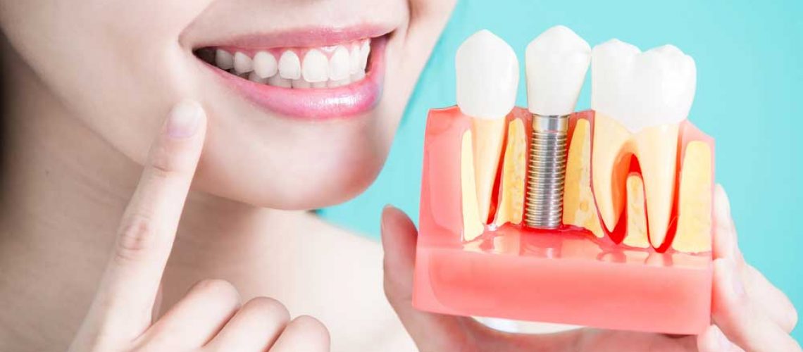 a dental patient holding a model of a placed dental implant